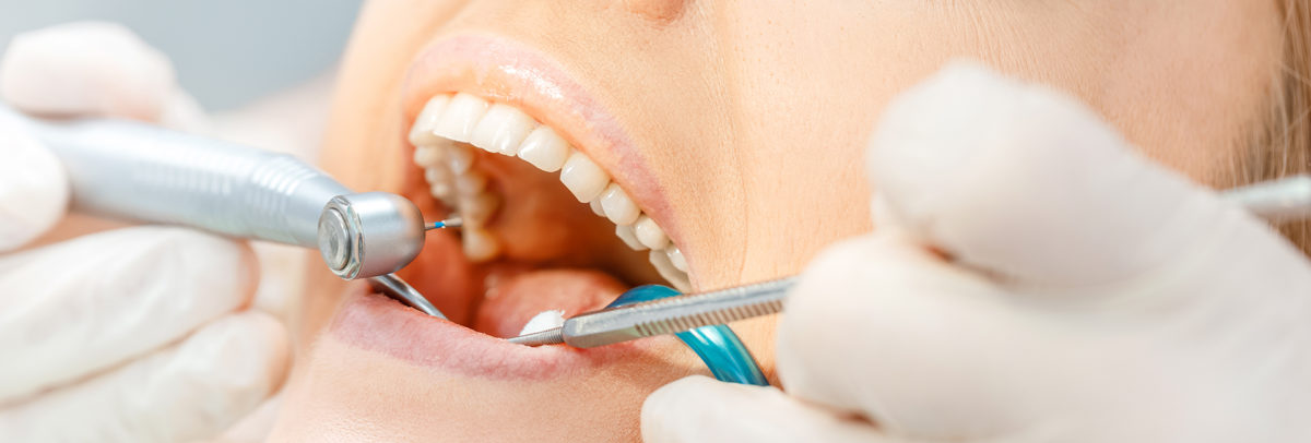 Dentist in Shoreline, Ballard WA, Greenwood WA