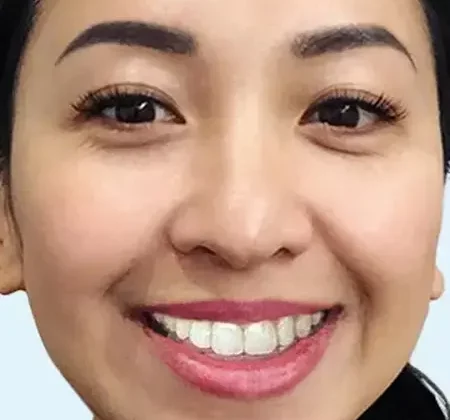 General Dentistry in Seattle, Shoreline, Ballard, WA, Greenwood, WA, Northgate, WA, Fremont, WA
